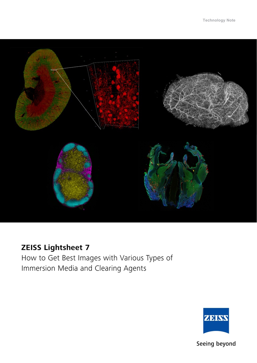 Optimize Your ZEISS Lightsheet 7 Imaging