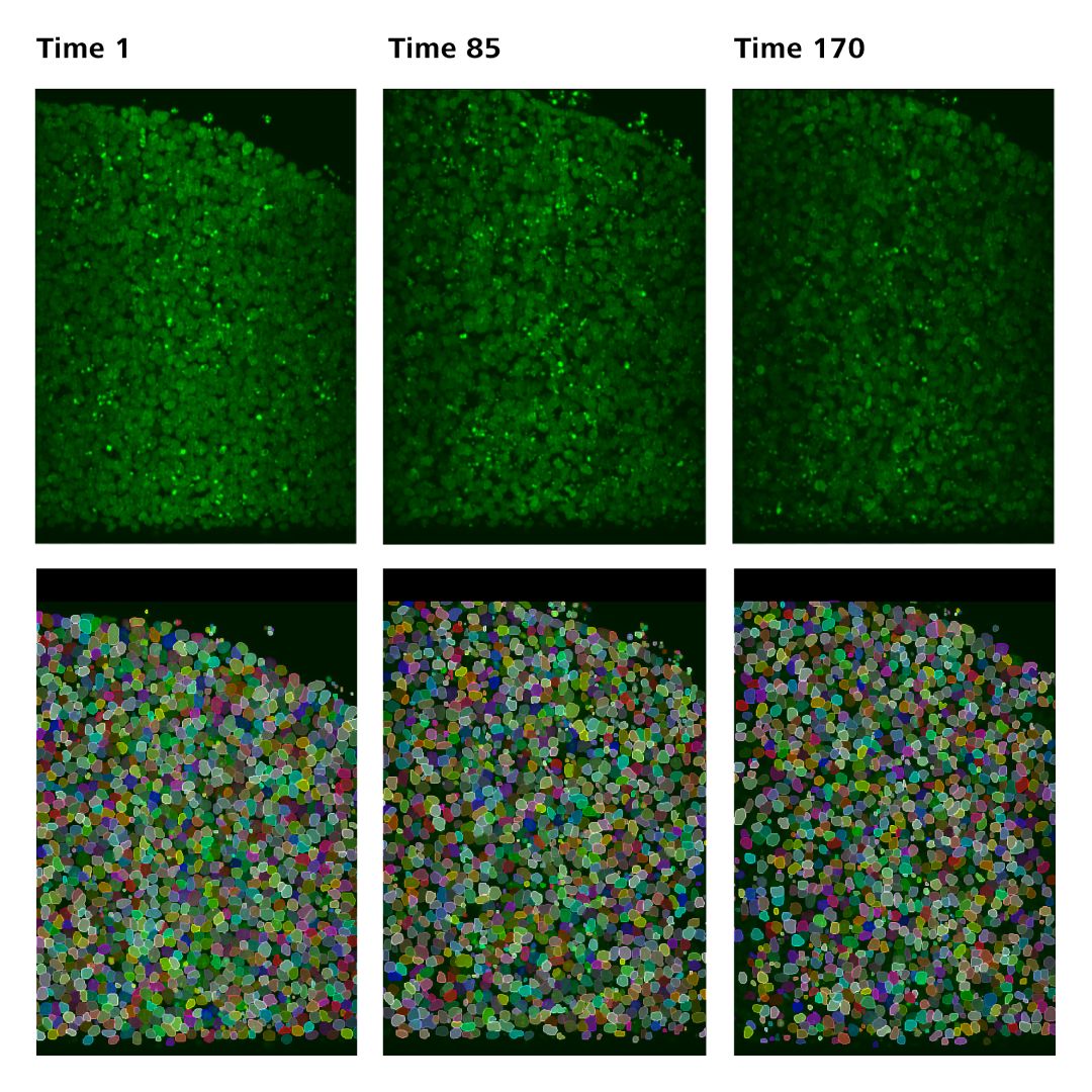 Two rows of three images each from three time points. The top row shows live-cell imaging with varying shades of green fluorescent areas in the image, indicating different intensities within each image and across time points. The bottom row shows images of cell nuclei with increasingly distinct boundaries from time point to time point due to segmentation by the ZEISS arivis Pro software, indicating the accuracy of the instance segmentation model.